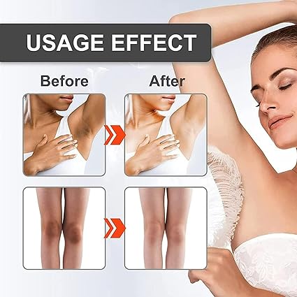 LAST DAY OF DISCOUNT š„ Dark Spot Remover Cream (30ml)