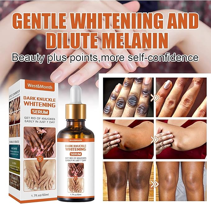 Dark Knuckles Whitening Serum