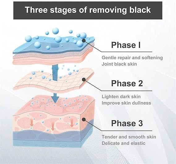 LAST DAY OF DISCOUNT 🔥 Dark Spot Remover Cream (30ml)